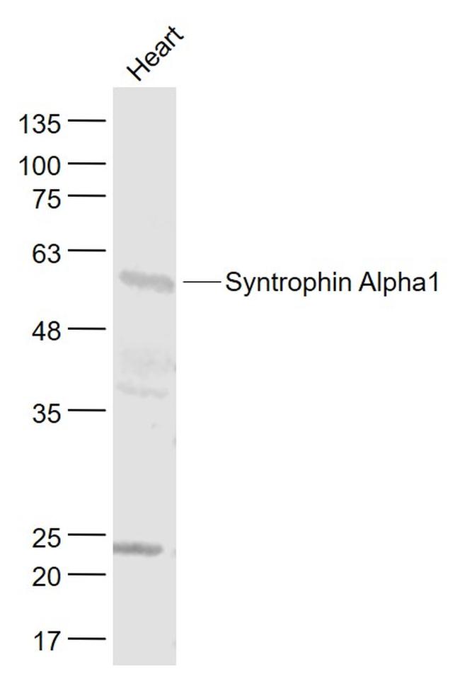 Syntrophin/SNTA1/Syntrophin Alpha1 Antibody in Western Blot (WB)