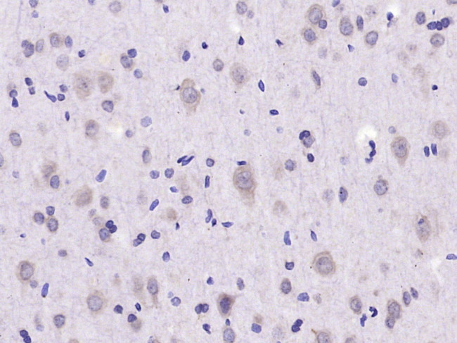 e2 alpha Antibody in Immunohistochemistry (Paraffin) (IHC (P))