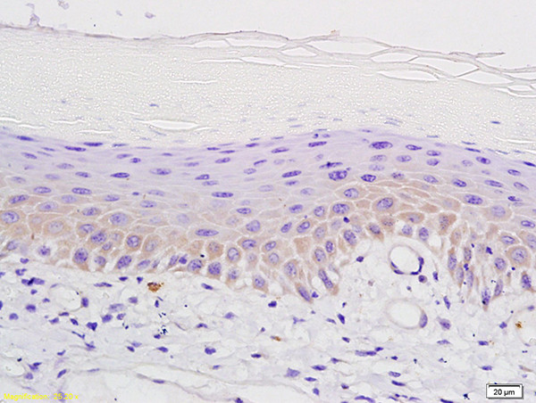 mu Opioid receptor Antibody in Immunohistochemistry (Paraffin) (IHC (P))