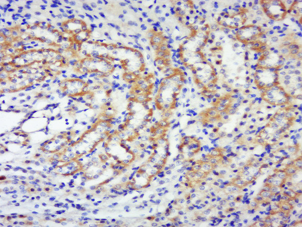 Phospho-p70 S6 Kinase Beta (Thr444, Ser447) Antibody in Immunohistochemistry (Paraffin) (IHC (P))