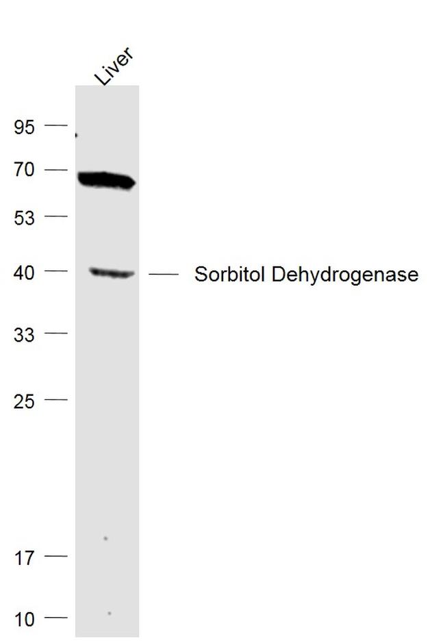 SDH/Sorbitol Dehydrogenase Antibody in Western Blot (WB)