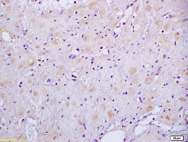 HSD17B1 Antibody in Immunohistochemistry (Paraffin) (IHC (P))