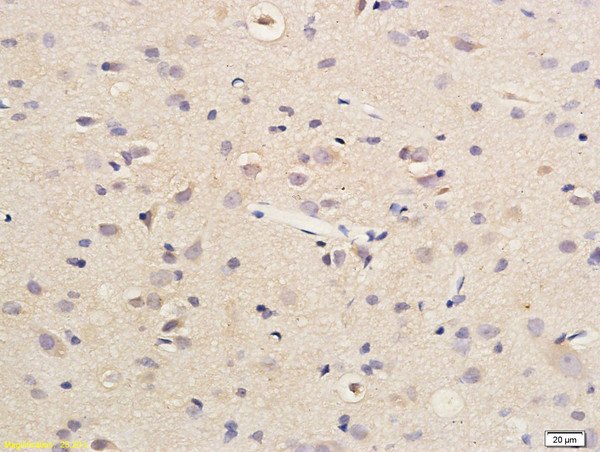 SDHD Antibody in Immunohistochemistry (Paraffin) (IHC (P))