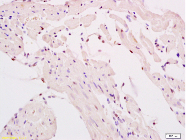 SMURF2 Antibody in Immunohistochemistry (Paraffin) (IHC (P))