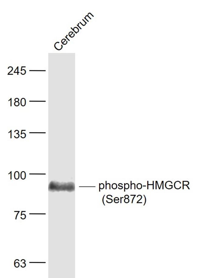 Phospho-HMGCR (Ser872) Antibody in Western Blot (WB)