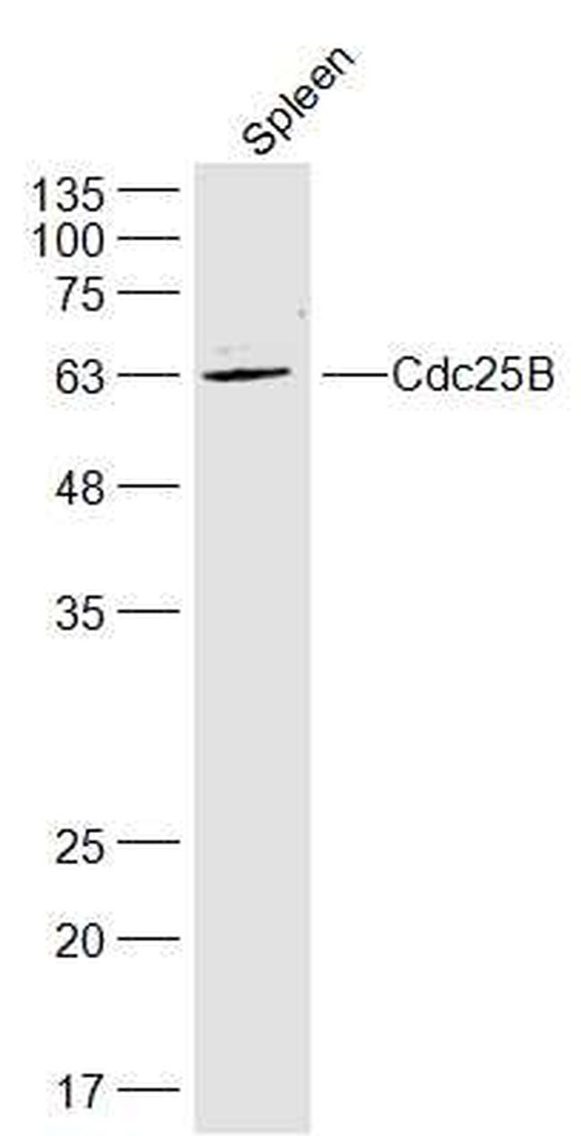 Cdc25B Antibody in Western Blot (WB)