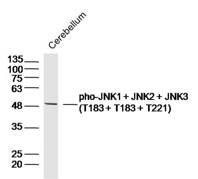 Phospho-JNK1/JNK2/JNK3 (Thr183, Thr183, Thr221) Antibody in Western Blot (WB)