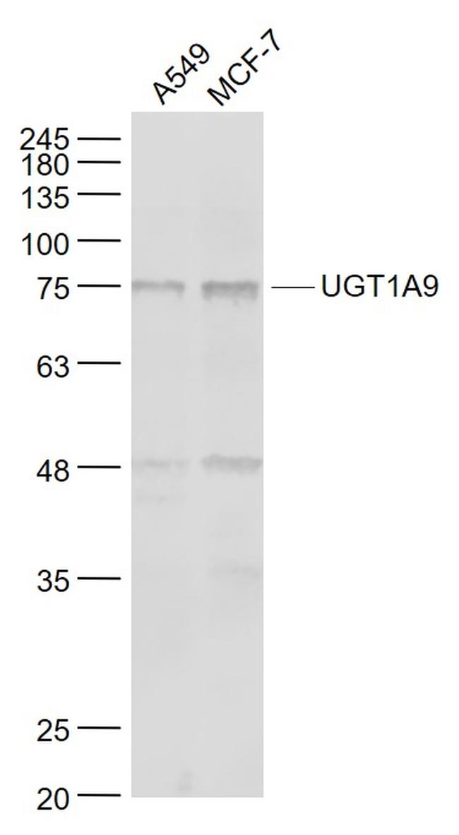 UGT1A9 Antibody in Western Blot (WB)