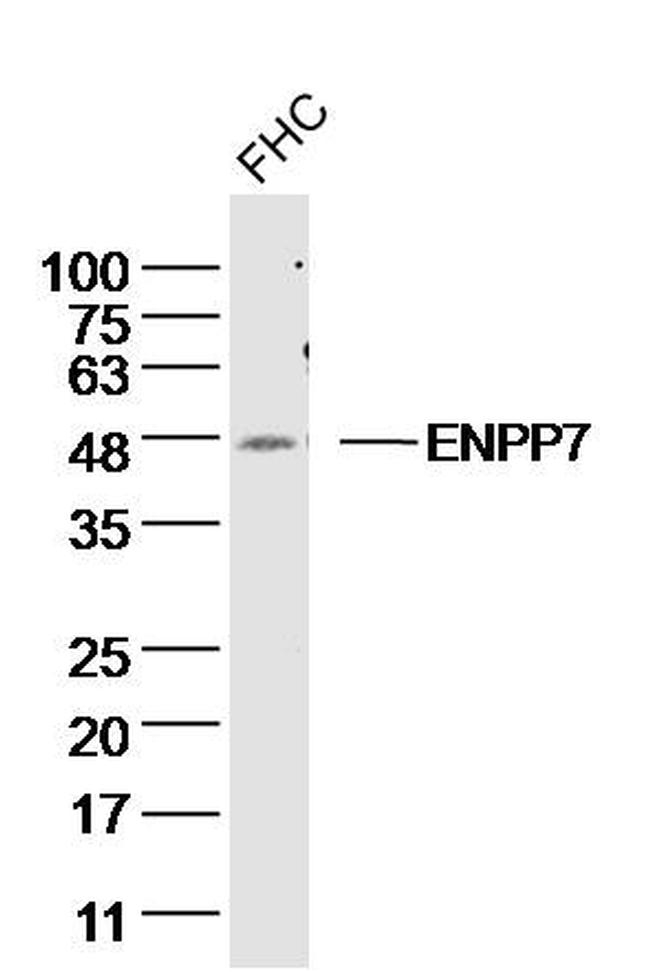 ENPP7 Antibody in Western Blot (WB)