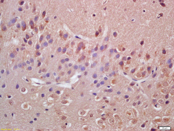 VAV3 Antibody in Immunohistochemistry (Paraffin) (IHC (P))