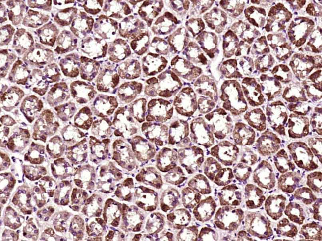 MACC1 Antibody in Immunohistochemistry (Paraffin) (IHC (P))