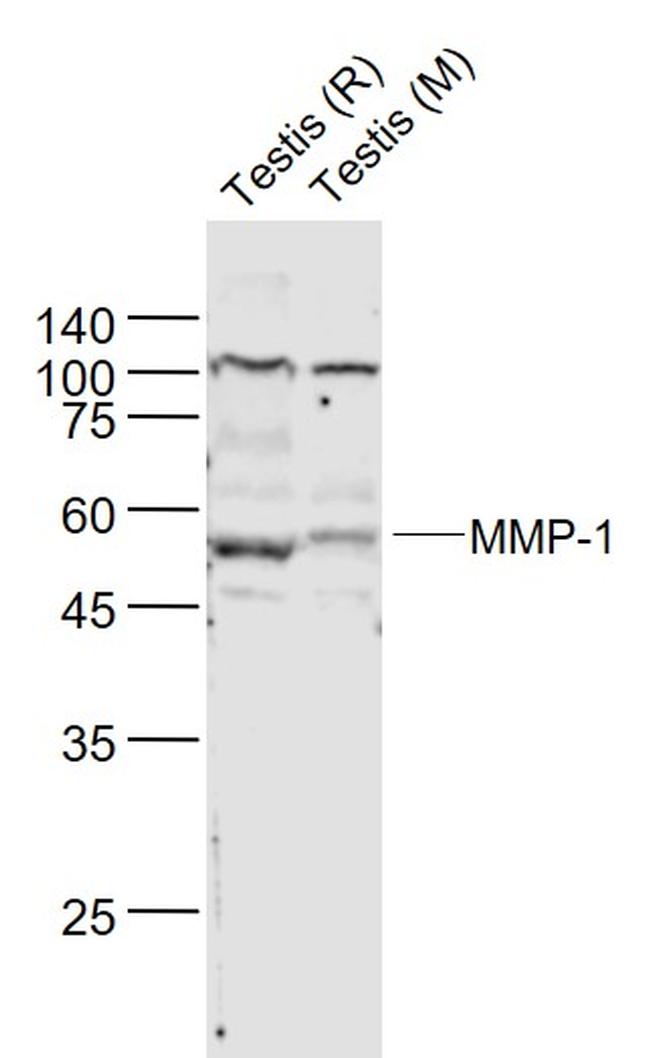 MMP-1 Antibody in Western Blot (WB)
