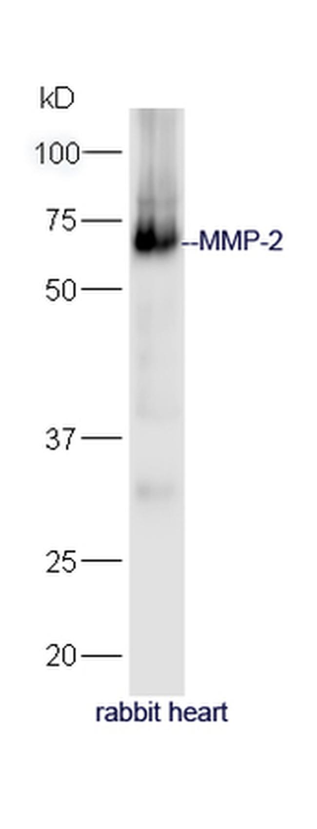 MMP-2 Antibody in Western Blot (WB)