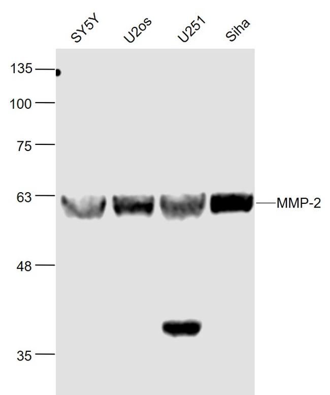 MMP-2 Antibody in Western Blot (WB)