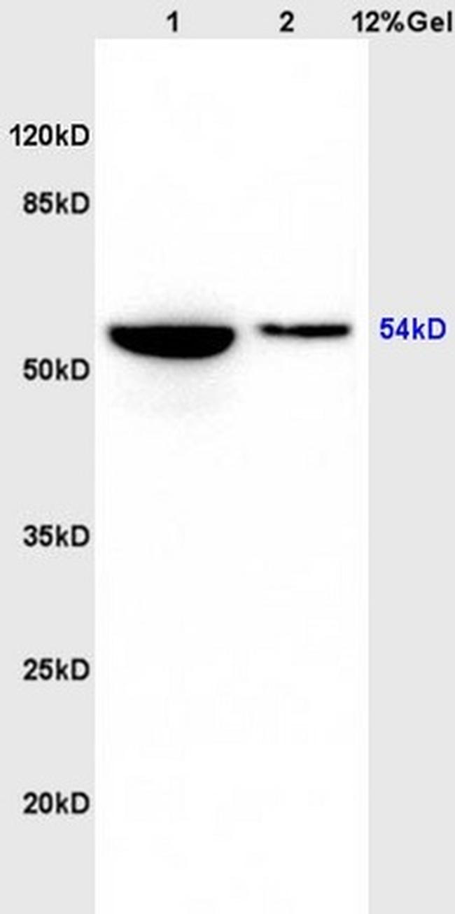 Phospho-GSK3 Alpha (Ser21) Antibody in Western Blot (WB)