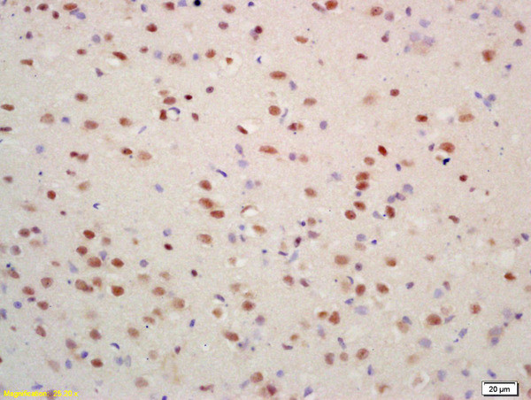 Acetyl-Histone H4 (Lys17) Antibody in Immunohistochemistry (Paraffin) (IHC (P))