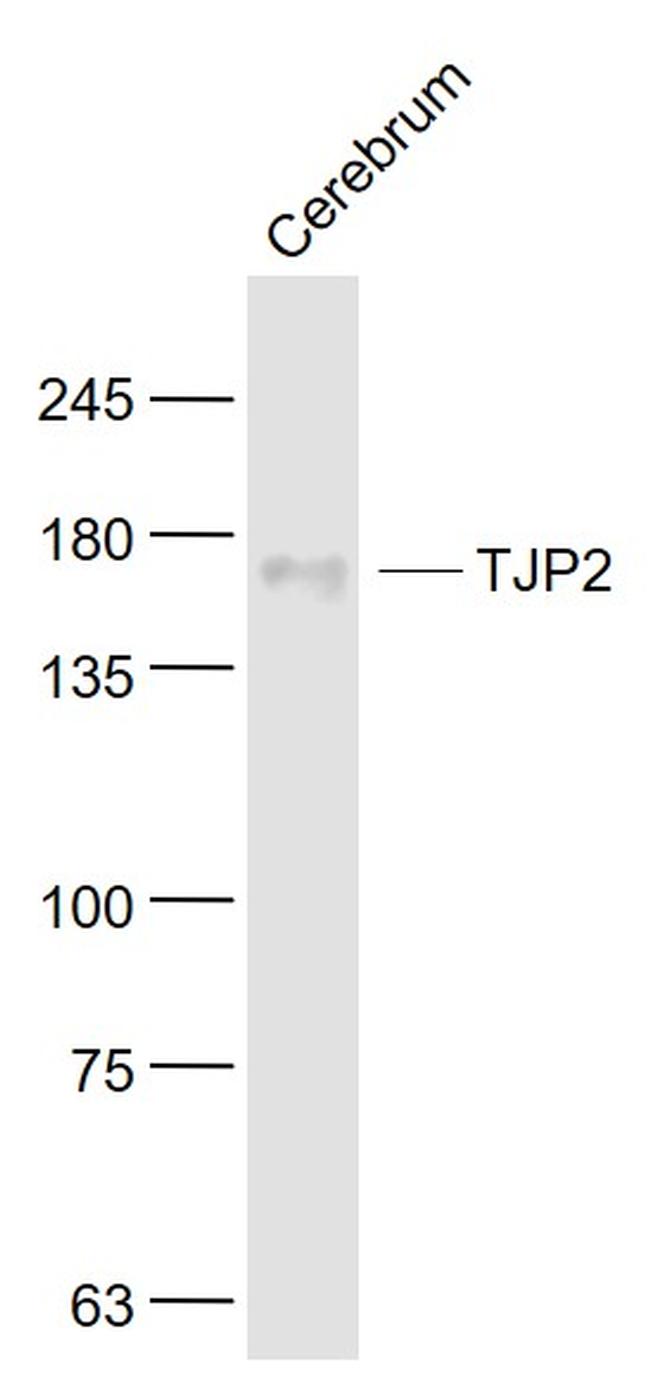 TJP2 Antibody in Western Blot (WB)