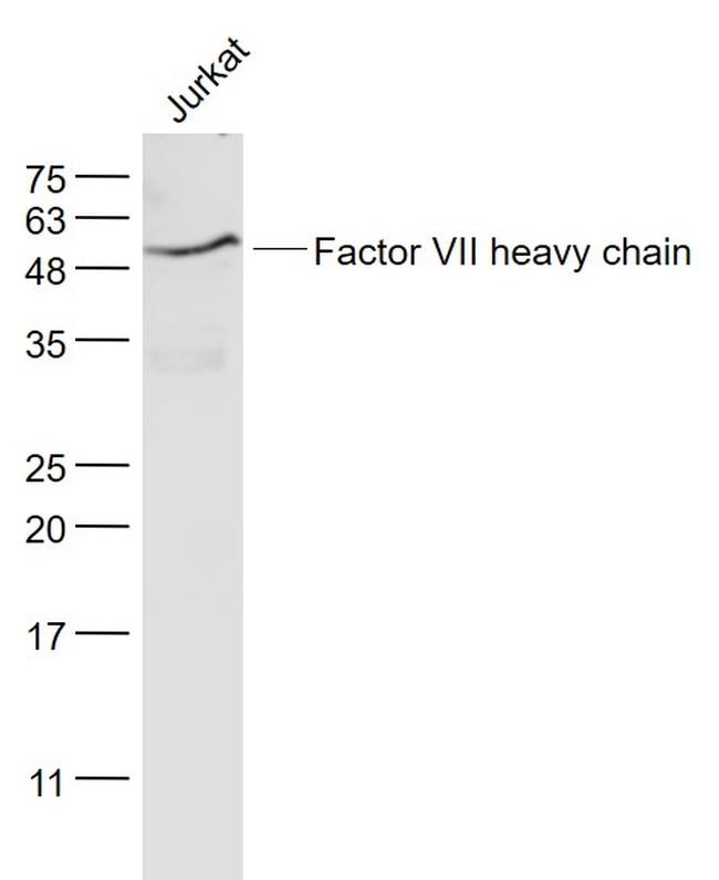 Factor 7 Antibody in Western Blot (WB)