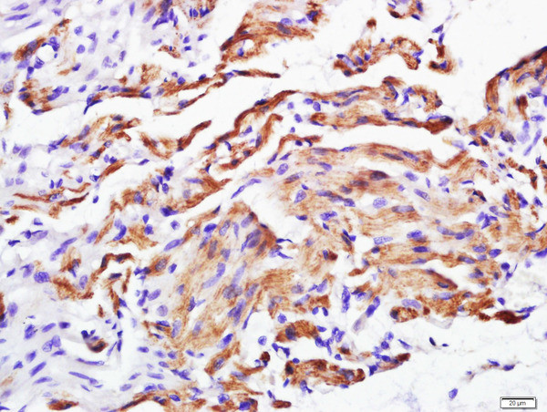 Calponin 2 + 3 Antibody in Immunohistochemistry (Paraffin) (IHC (P))