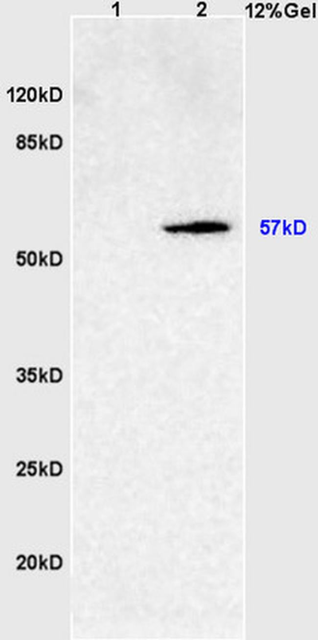 SOAT2 Antibody in Western Blot (WB)