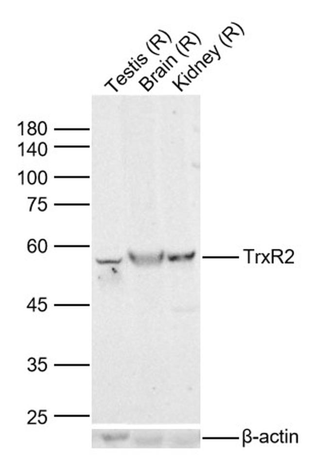 Thioredoxin Reductase 2 Antibody in Western Blot (WB)