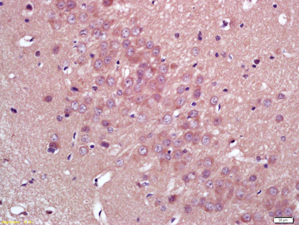 HMGCR Antibody in Immunohistochemistry (Paraffin) (IHC (P))