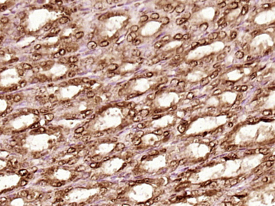 Hsc70 Antibody in Immunohistochemistry (Paraffin) (IHC (P))