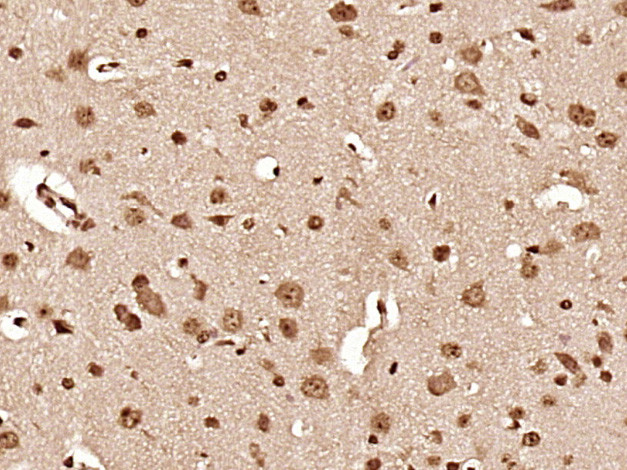 Hsc70 Antibody in Immunohistochemistry (Paraffin) (IHC (P))