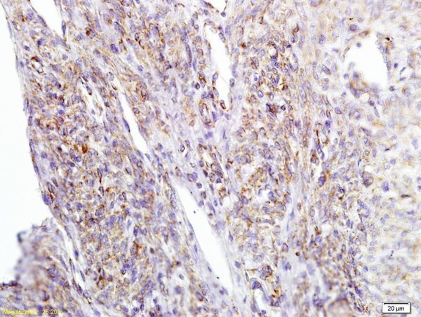 Girdin Antibody in Immunohistochemistry (Paraffin) (IHC (P))