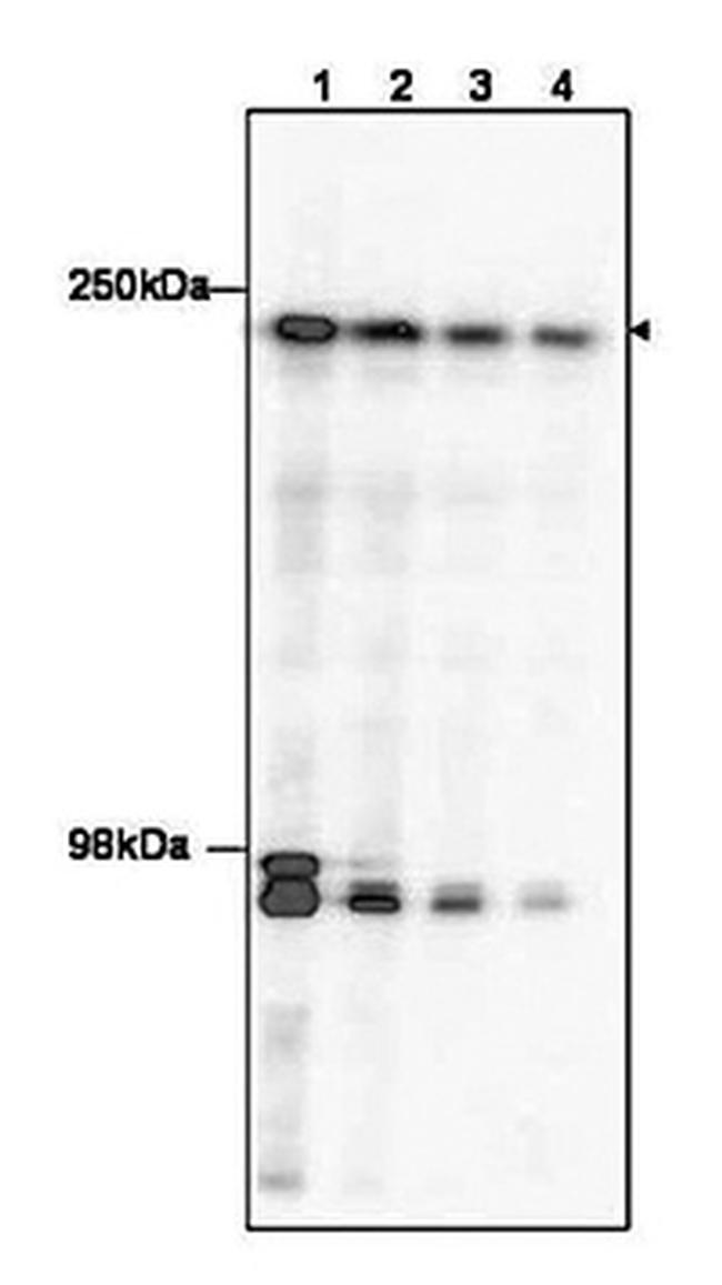 TAF1 Antibody in Western Blot (WB)
