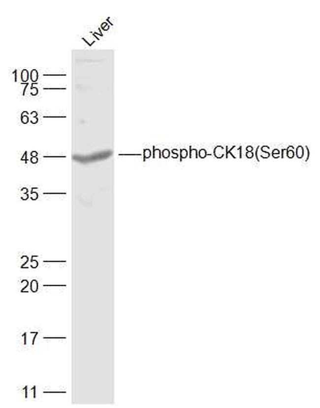 Phospho-CK18 (Ser60) Antibody in Western Blot (WB)