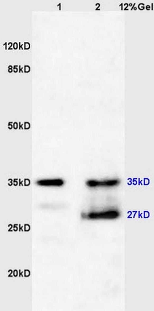 Phospho-NFKBIA (Tyr305) Antibody in Western Blot (WB)