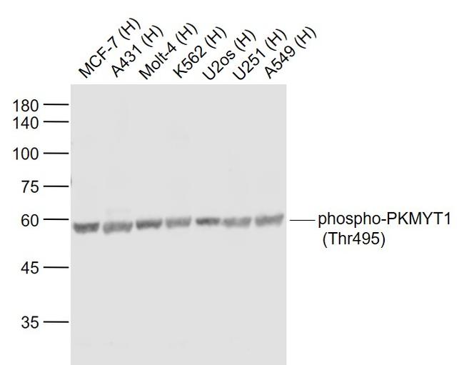 Phospho-PKMYT1 (Thr495) Antibody in Western Blot (WB)