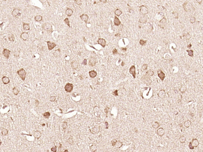 BNIP3L Antibody in Immunohistochemistry (Paraffin) (IHC (P))