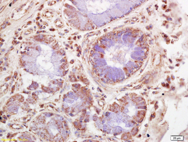 NUAK2 Antibody in Immunohistochemistry (Paraffin) (IHC (P))