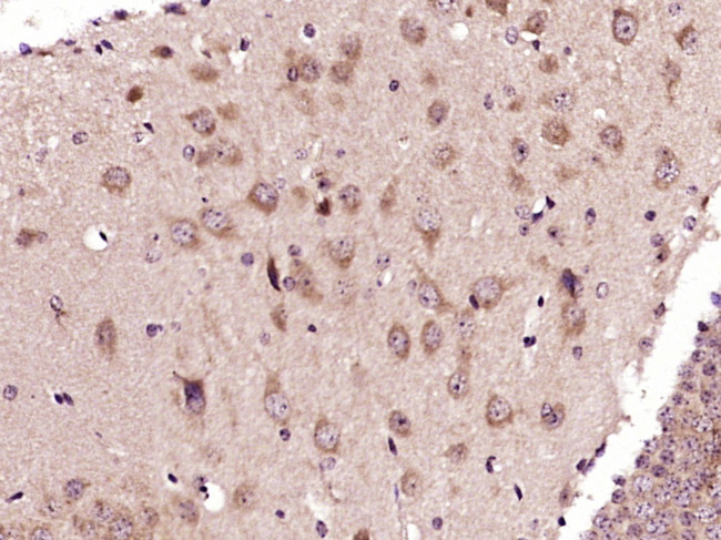 ADORA2B Antibody in Immunohistochemistry (Paraffin) (IHC (P))