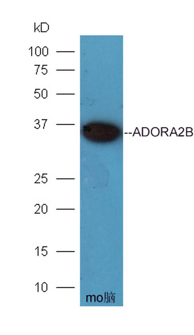 ADORA2B Antibody in Western Blot (WB)