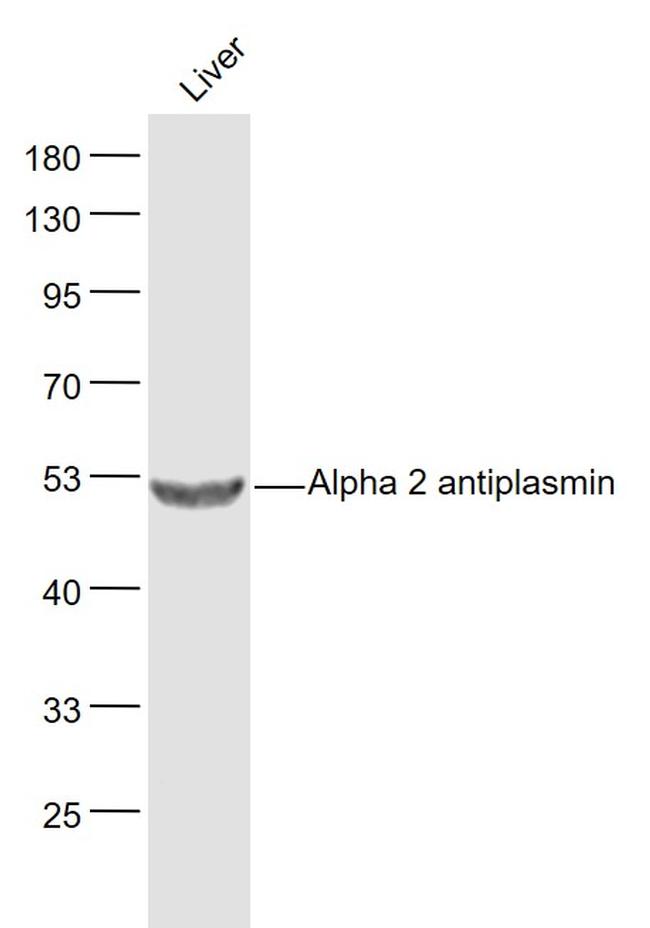 Alpha 2 antiplasmin Antibody in Western Blot (WB)