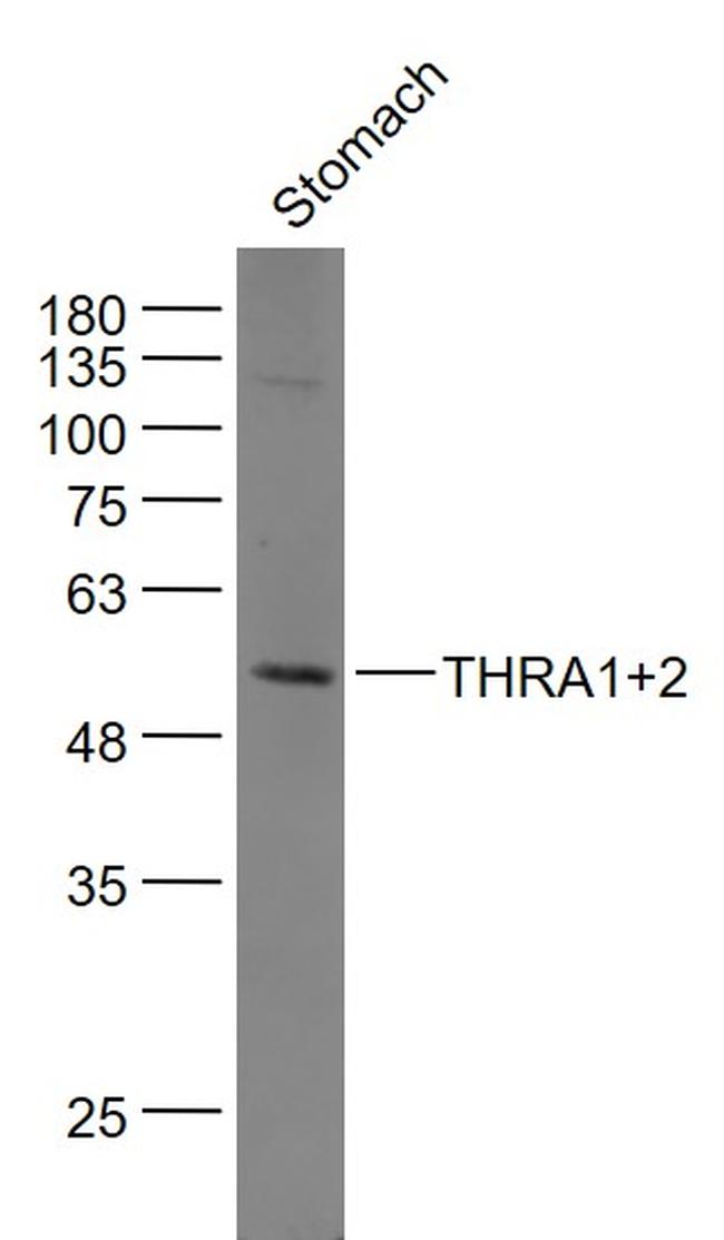 THRA1/2 Antibody in Western Blot (WB)