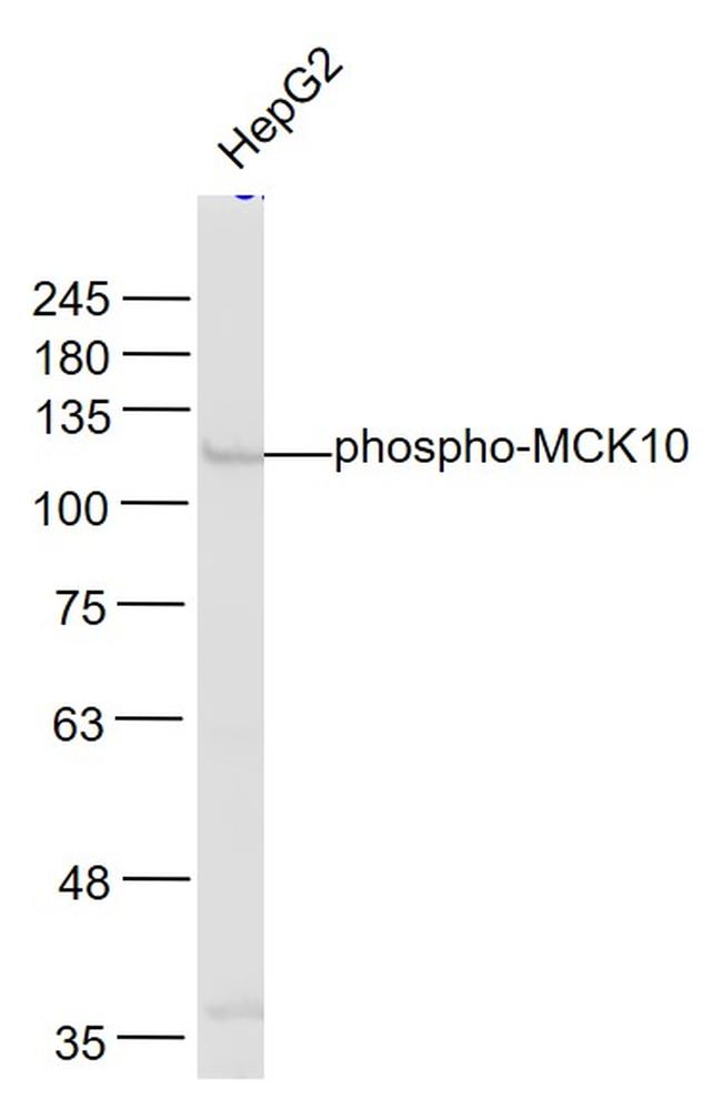 Phospho-MCK10 (Tyr513) Antibody in Western Blot (WB)