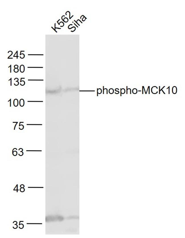 Phospho-MCK10 (Tyr513) Antibody in Western Blot (WB)