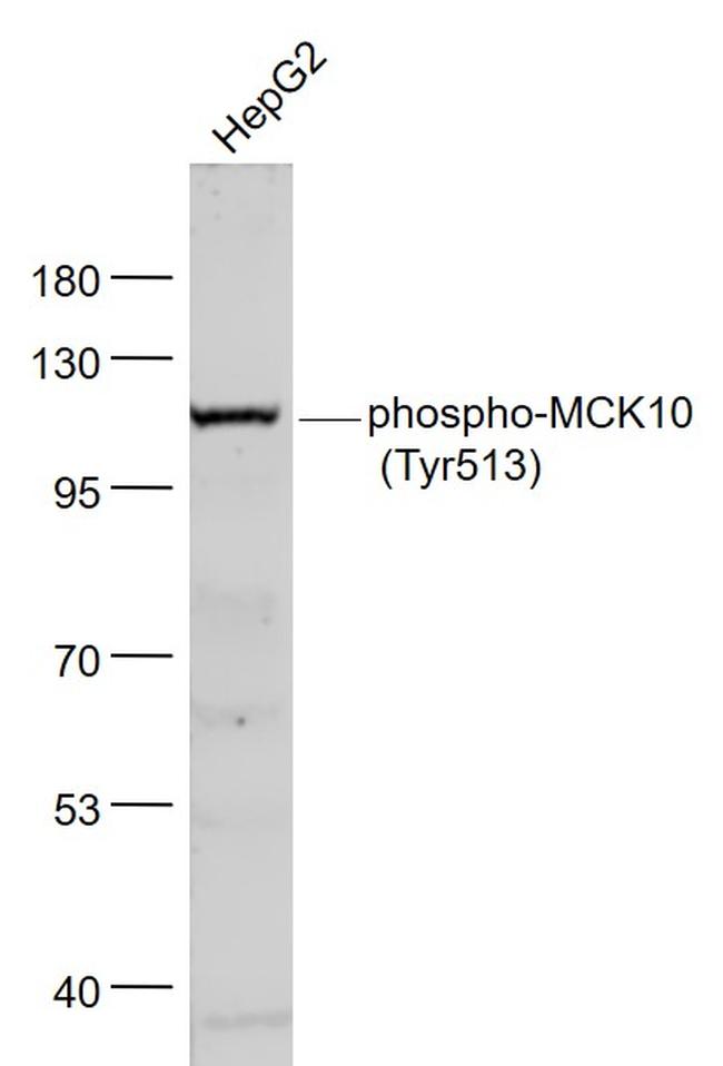 Phospho-MCK10 (Tyr513) Antibody in Western Blot (WB)