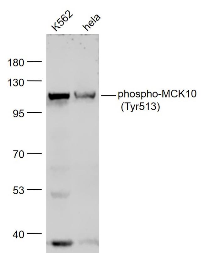 Phospho-MCK10 (Tyr513) Antibody in Western Blot (WB)
