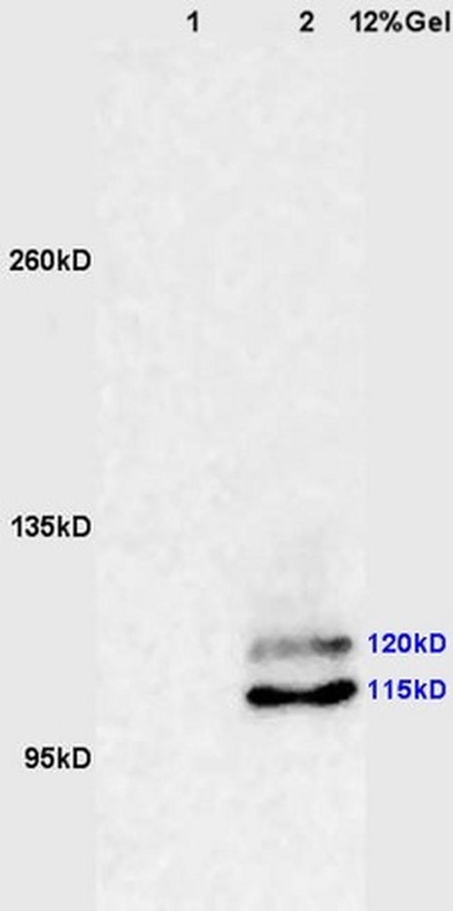 Phospho-PI3 Kinase p110 beta (Ser1070) Antibody in Western Blot (WB)