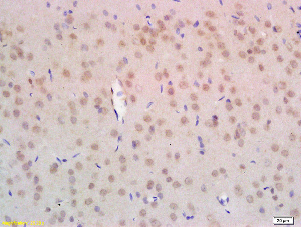 NPD014 Antibody in Immunohistochemistry (Paraffin) (IHC (P))