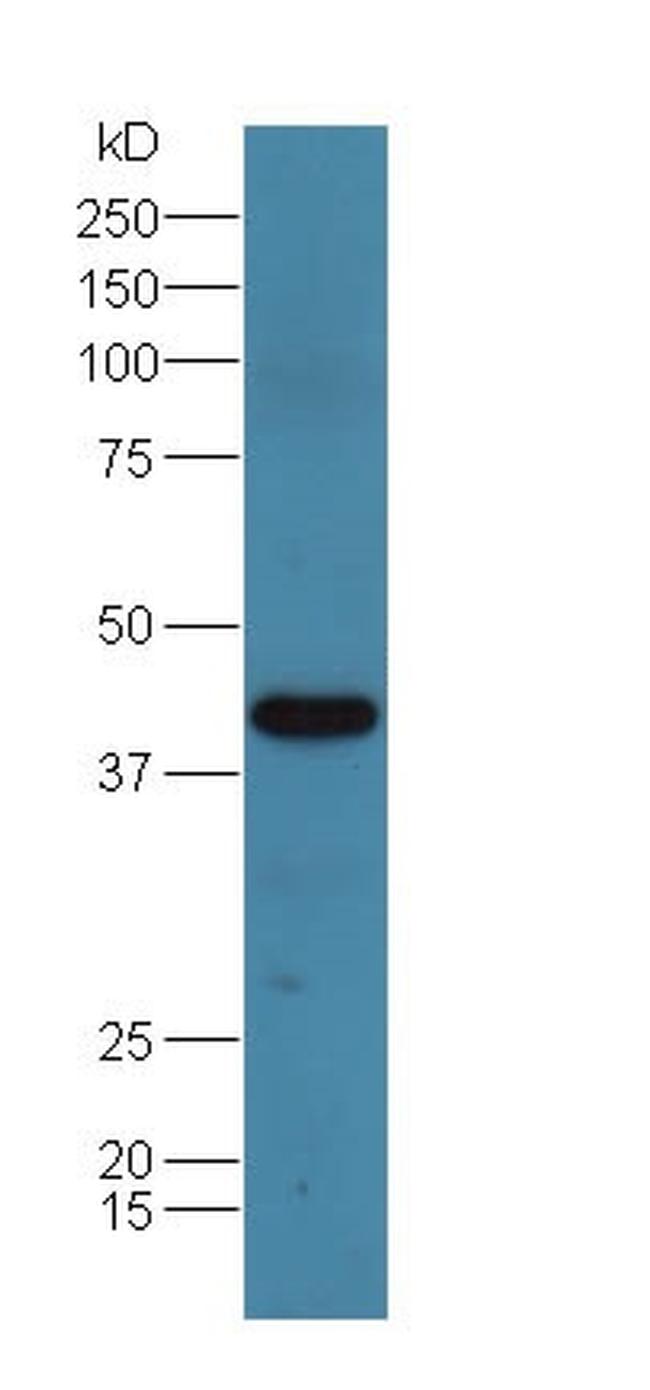 Adenosine deaminase Antibody in Western Blot (WB)