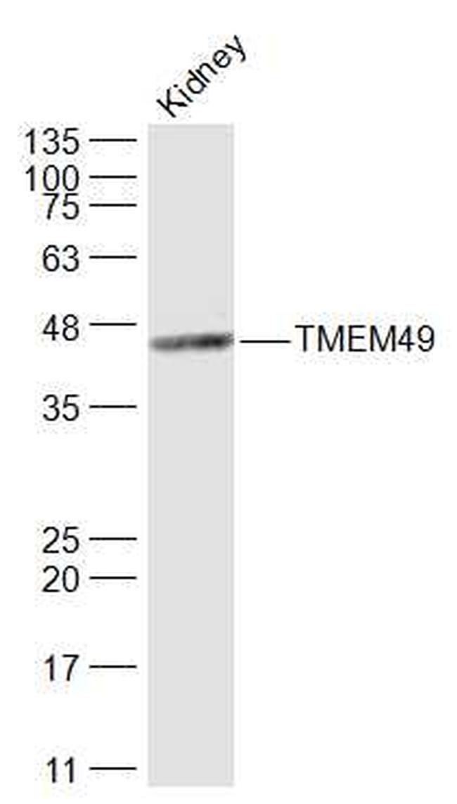 TMEM49 Antibody in Western Blot (WB)