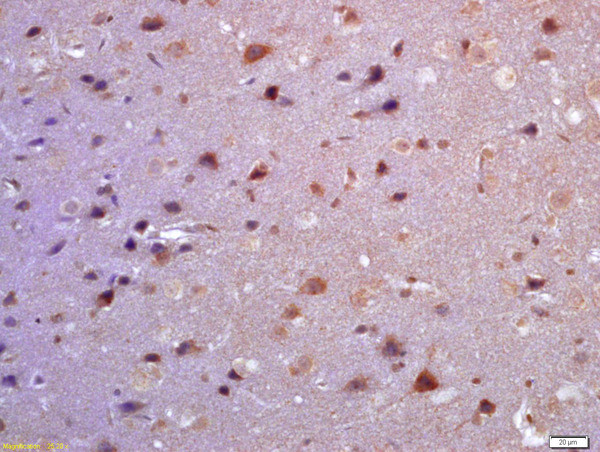 TSSC3 Antibody in Immunohistochemistry (Paraffin) (IHC (P))