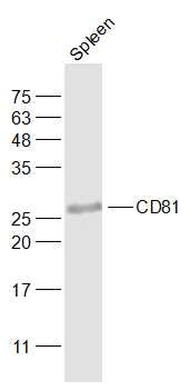 CD81 Antibody in Western Blot (WB)