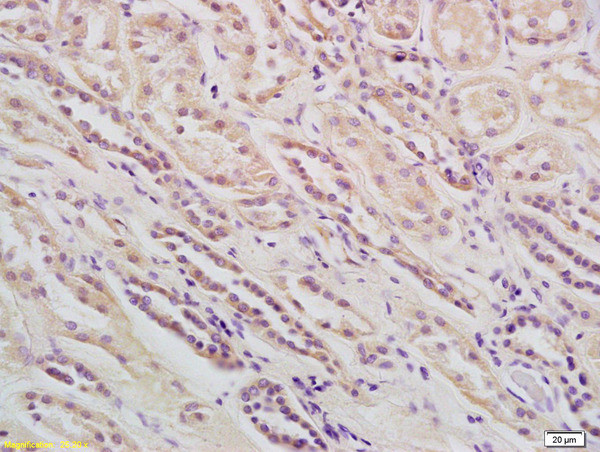 Phospholipase C beta 1 Antibody in Immunohistochemistry (Paraffin) (IHC (P))